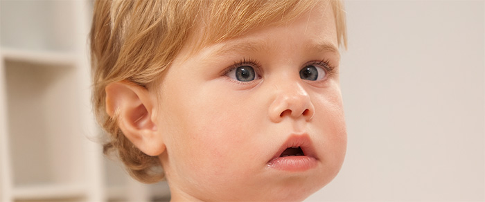 Strabismus